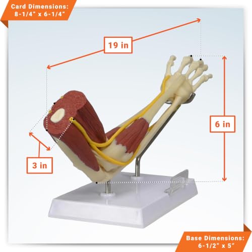 GPI Anatomicals Muscled Elbow ModelModel of Right Elbow with Muscles - style: Muscled Elbow