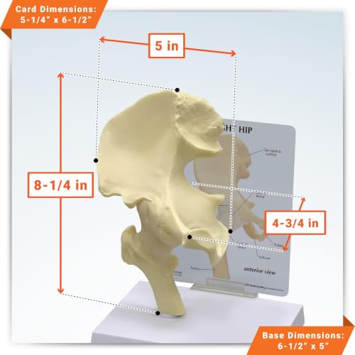 GPI Anatomicals Basic Hip Model, Right Hip Joint Replica - style: Right Hip Joint