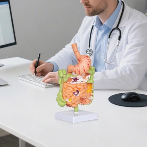 Stomach Anatomy Model, Intestine Removerable Teaching Display