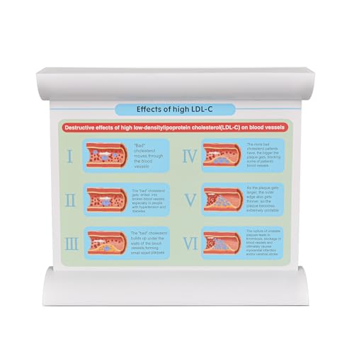 4-Stage Atherosclerosis Artery Model, LDL Plaque Blood Vessel Teaching Aid