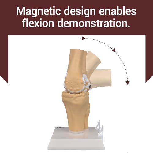 1.2X Enlarged Arthritis Joint Model, Osteoarthritis Anatomy Teaching Tool