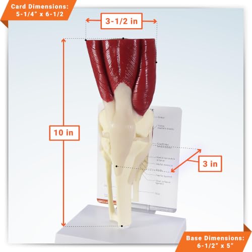 GPI Anatomicals Muscled Knee ModelRight Knee Joint with Muscles Model - style: Muscled Knee