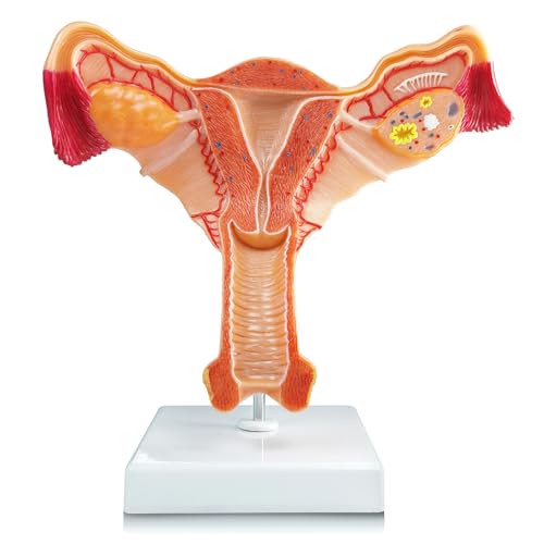Human Uterus and Ovary Anatomical Model, Life-Size Realistic Female Anatomical Organs for Medical Science Education Study or Teaching