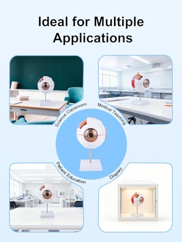 6X Enlarged Eyeball Model Detachable Eye Anatomy Model with Stand for Medical Science Education & Classroom Display
