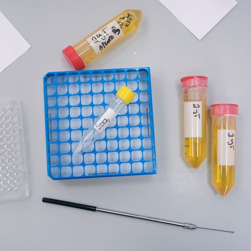 PATIKIL 100 Well Centrifuge Tube Freezer Storage Box, 2 Pcs Polypropylene Lockable Tube Rack for 1.5/1.8/2ML Tubes Vials Samples, Red - color: Red