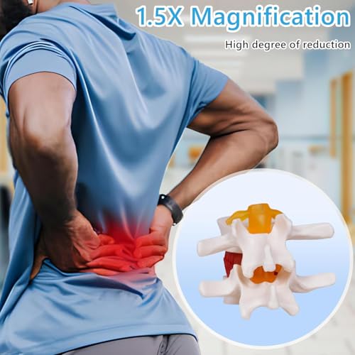 NLShan Human Anatomical Lumbar Disc Herniation Model, Portable Herniated Lumbar Vertebrae Disc, 1.5 Times Life Size Lumbar Spine Model for Learning, Teaching and Demonstrating