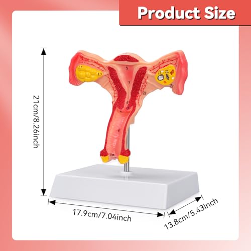 Human Uterus and Ovary Anatomical Model, Female Anatomy Organ for Education