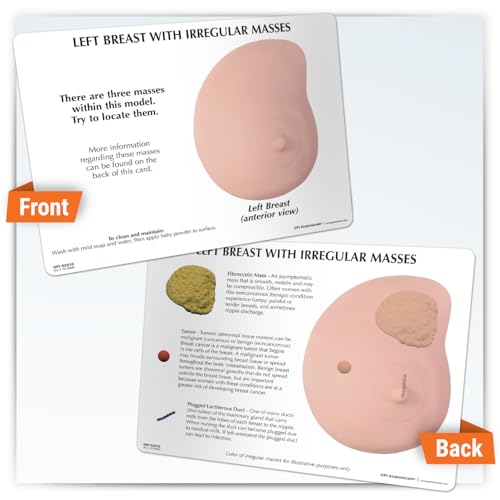 GPI Anatomicals Human Anatomy Model of Left Breast with Irregular Masses - style: Left Breast with Irregular Masses