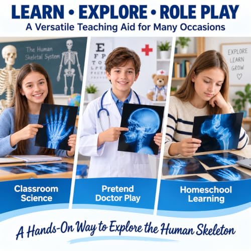 16 Pcs Broken Bones X-Ray Set Human Anatomy STEM Classroom Learning Films