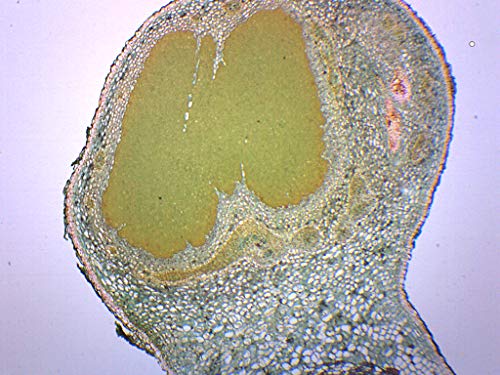 Legume Root Nodule - Prepared Microscope Slide - 75 x 25mm - Biology & Microscopy - Eisco Labs - size: Single Slide