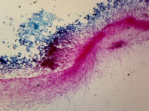 PS0115: Penicillium