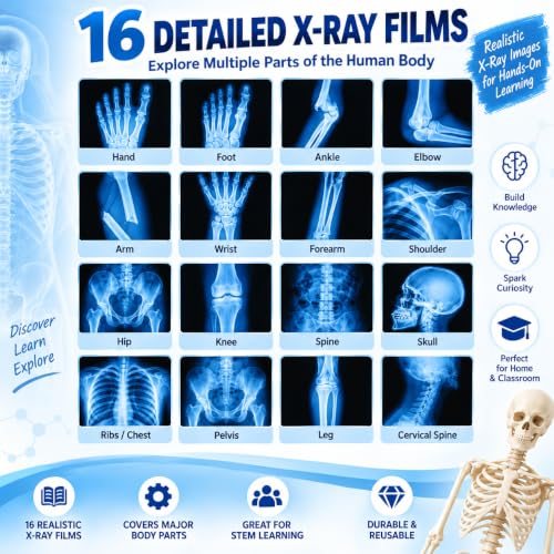 16 Pcs Broken Bones X-Ray Set Human Anatomy STEM Classroom Learning Films