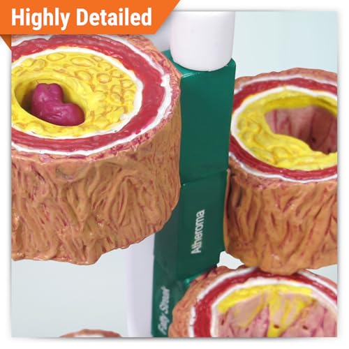 GPI Anatomicals 4-Piece Artery Model, Replica of an Artery with Plaque - style: Artery Model