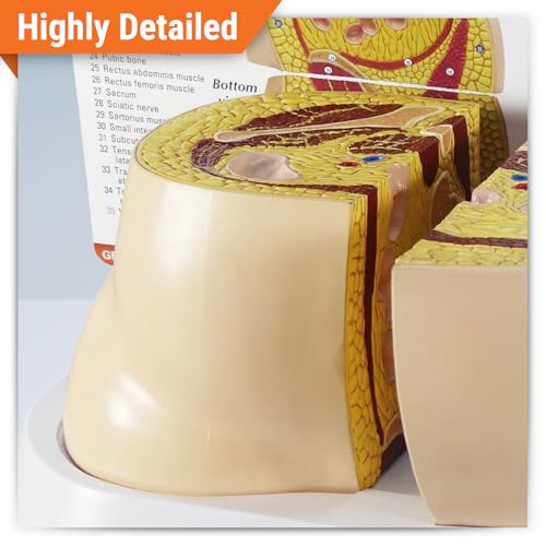 GPI Anatomicals Obesity Model of the Hip Area Depicting Effects of Obesity
