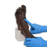 Wilma Wound Foot Model for Nursing and Healthcare Training