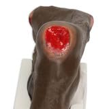 Wilma Wound Foot Model for Nursing and Healthcare Training