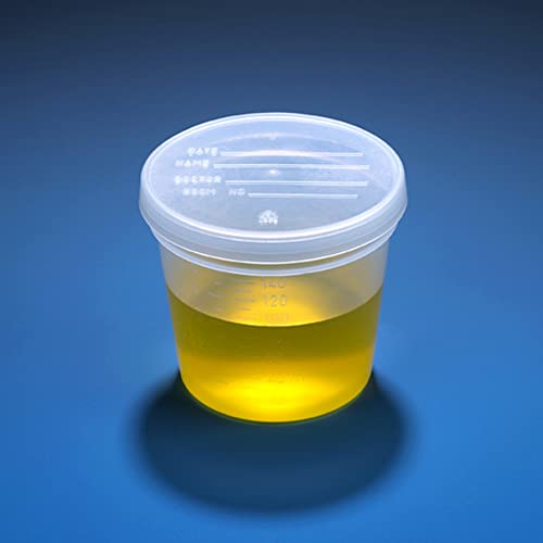 Globe Scientific 5917 Specimen Container with Separate Snap Cap, PP, Graduated, 5oz, 70mm Diameter, 67.7mm Height, Pack of 300