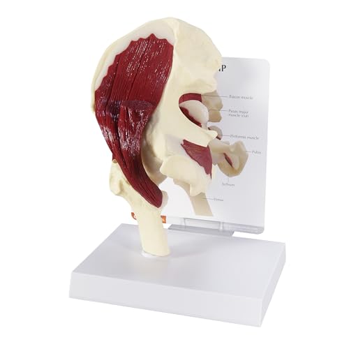 GPI Anatomicals Muscled Hip Model of Right Hip Joint with Muscles - style: Muscled Hip