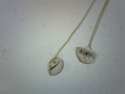 Rhizopus, Asexual Reproduction - Prepared Microscope Slide - 75 x 25mm - Biology & Microscopy - Eisco Labs - size: Single Slide