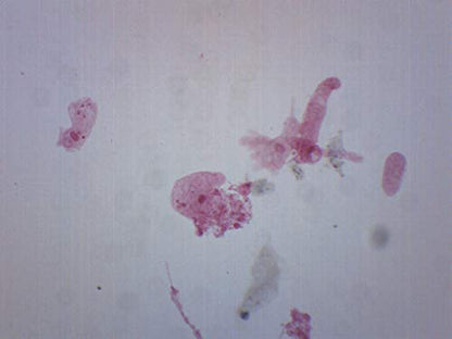 EISCO Amoeba Proteus, Whole Mount - Prepared Microscope Slide - 75 x 25mm - Biology & Microscopy - size: Single Slide