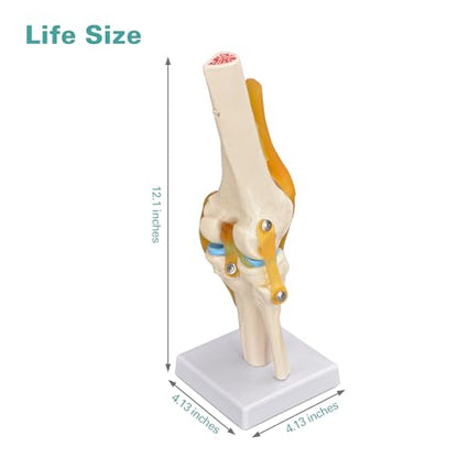 Human Knee Joint Model, 1:1 Scientific Life Size Anatomy Model with Ligaments, Anatomical Teaching Tool for Patient Education and Study