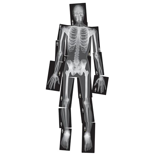 Human X-Rays – 18-Piece Life-Size Skeletal Set for Light Table or Window Exploration, Ages 5+ - style: Human