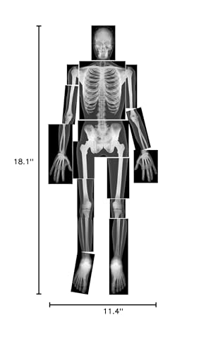 Roylco True to Life Human X-Rays