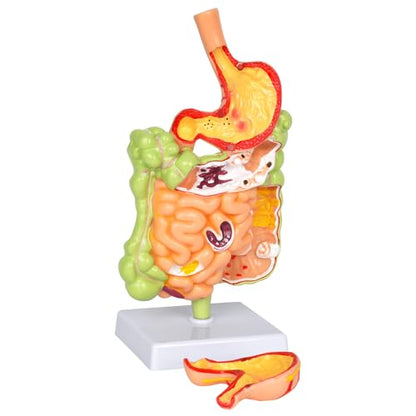 Stomach Anatomy Model, Intestine Removerable Teaching Display