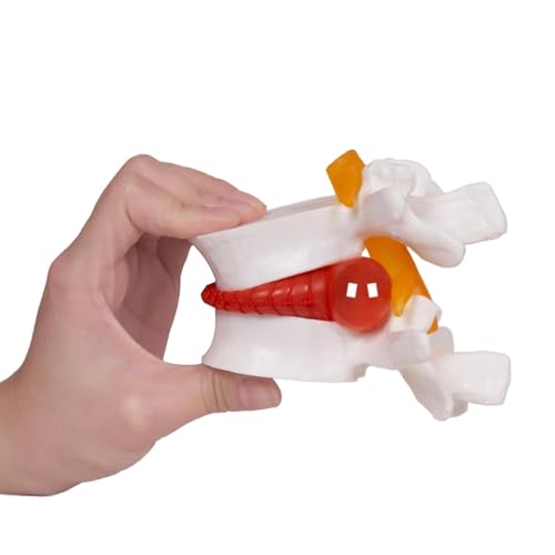 NLShan Human Anatomical Lumbar Disc Herniation Model, Portable Herniated Lumbar Vertebrae Disc, 1.5 Times Life Size Lumbar Spine Model for Learning, Teaching and Demonstrating
