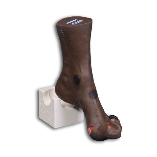 Wilma Wound Foot Model for Nursing and Healthcare Training