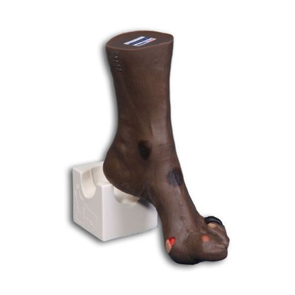 Wilma Wound Foot Model for Nursing and Healthcare Training