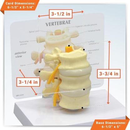 GPI Anatomicals Basic Vertebrae Model with L2, L3, and L4, Spine Model - style: Basic Vertebrae Model
