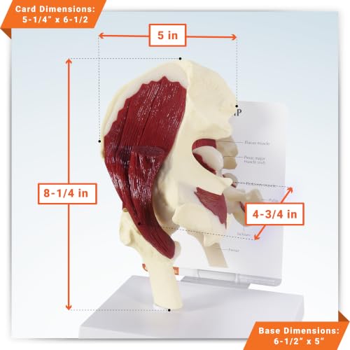 GPI Anatomicals Muscled Hip Model of Right Hip Joint with Muscles - style: Muscled Hip