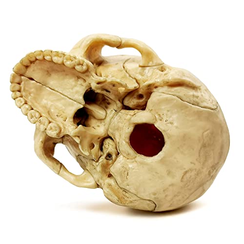 Anatomy Exploded Human Skull Model,Medical Model Dental Clinic