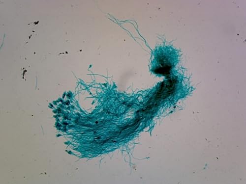 PS0110: Ascomycetes, Penicillium