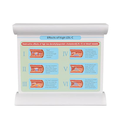 4-Stage Atherosclerosis Artery Model, LDL Plaque Blood Vessel Teaching Aid