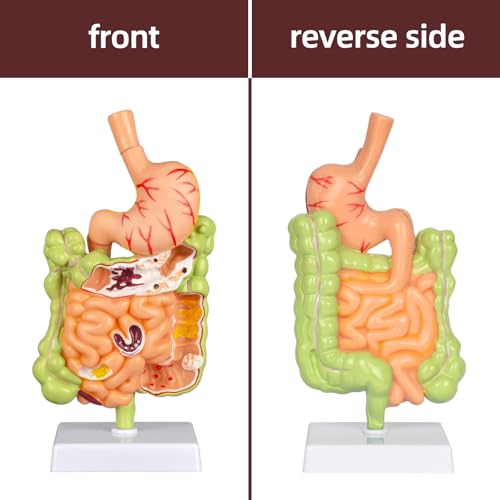 Stomach Anatomy Model, Intestine Removerable Teaching Display