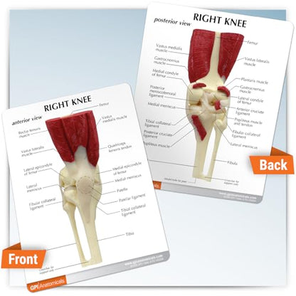 GPI Anatomicals Muscled Knee ModelRight Knee Joint with Muscles Model - style: Muscled Knee