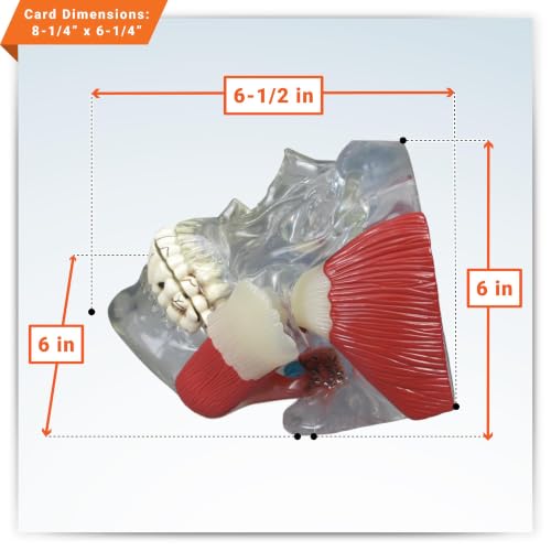 GPI Anatomicals Temporomandibular Joint (TMJ) Model with Pathologies