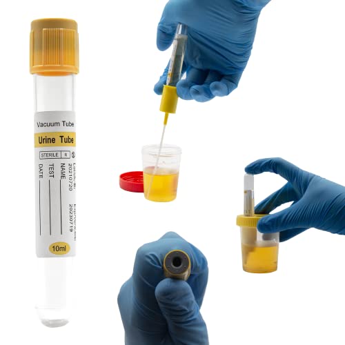 Kashi Scientific 10mL Urine Collection Vacuum Tube - Urinalysis Vacuum Tube with Yellow Cap, Pack of 100 Urine Tubes