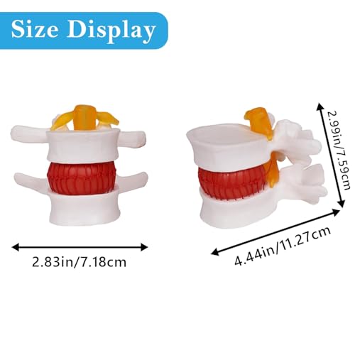 NLShan Human Anatomical Lumbar Disc Herniation Model, Portable Herniated Lumbar Vertebrae Disc, 1.5 Times Life Size Lumbar Spine Model for Learning, Teaching and Demonstrating