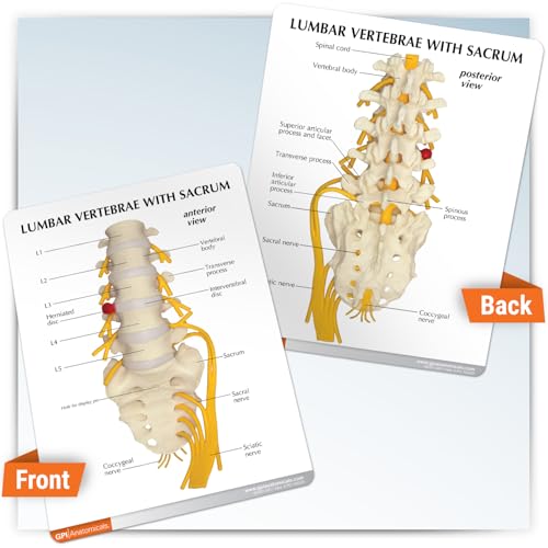 GPI Anatomicals 5-Piece Vertebrae Model with Sacrum, Spine Model - style: 5-Piece Vertebrae Model with Sarcum