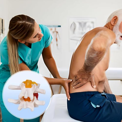 NLShan Human Anatomical Lumbar Disc Herniation Model, Portable Herniated Lumbar Vertebrae Disc, 1.5 Times Life Size Lumbar Spine Model for Learning, Teaching and Demonstrating