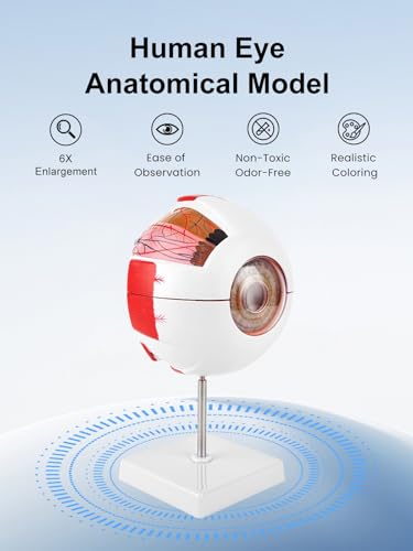 6X Enlarged Eyeball Model Detachable Eye Anatomy Model with Stand for Medical Science Education & Classroom Display
