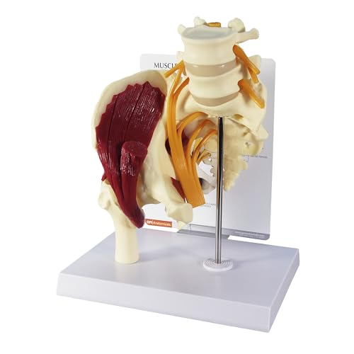 GPI Anatomicals Muscled Hip Model, Replica of Right Hip Joint - style: Muscled Hip with Sciatic Nerve