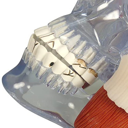 GPI Anatomicals Temporomandibular Joint (TMJ) Model with Pathologies