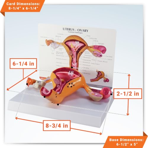 GPI Anatomicals Uterus and Ovary Model, Female Reproductive System - style: Uterus and ovary