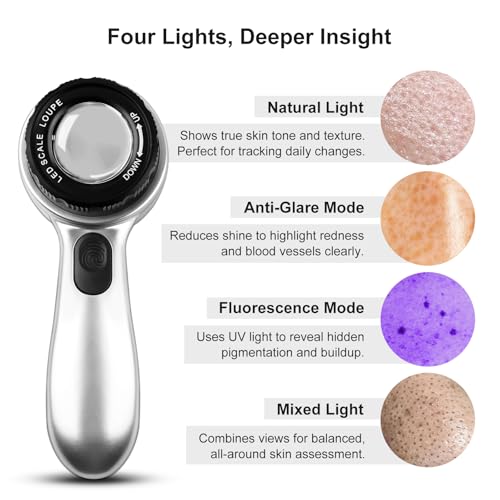 30x LED Dermatoscope Rechargeable Clarity 4 Modes Skin Scalp Hair