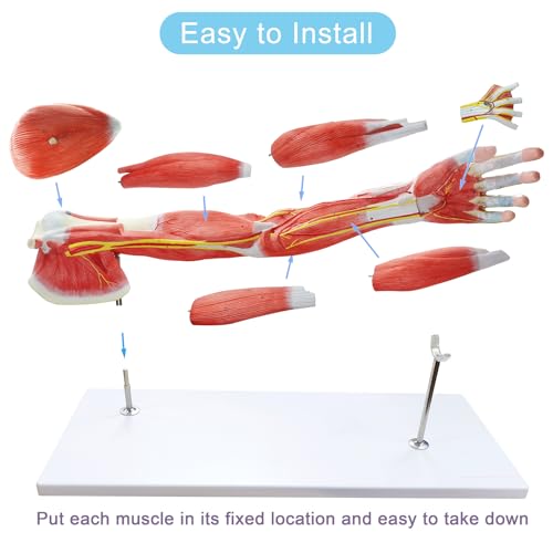 EVOTECH SCIENTIFIC Human Anatomical Muscular Arm Model, 7 Part Life Size