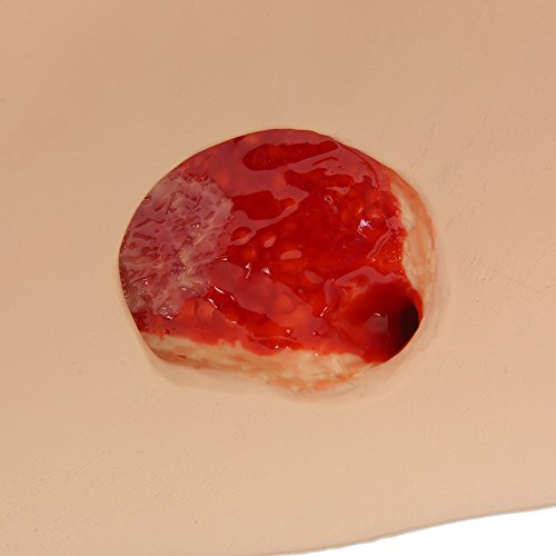 VATA Seymour II Wound Care Model